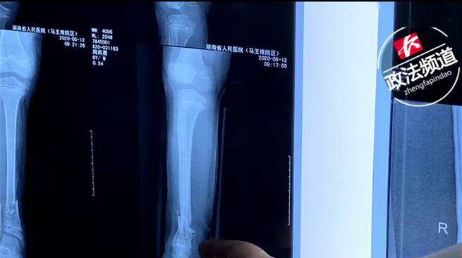 保镖2011 相关产品