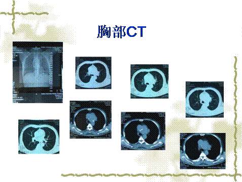 亲爱的宝贝侄女 相关产品